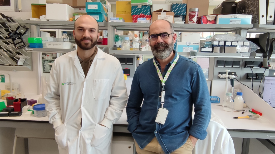 Epigenetic features of blood monocytes can anticipate Rheumatoid Arthritis progression