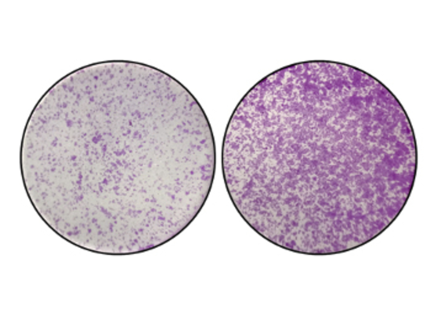 A cancer mystery of more than forty years ago is solved thanks to Epigenetics